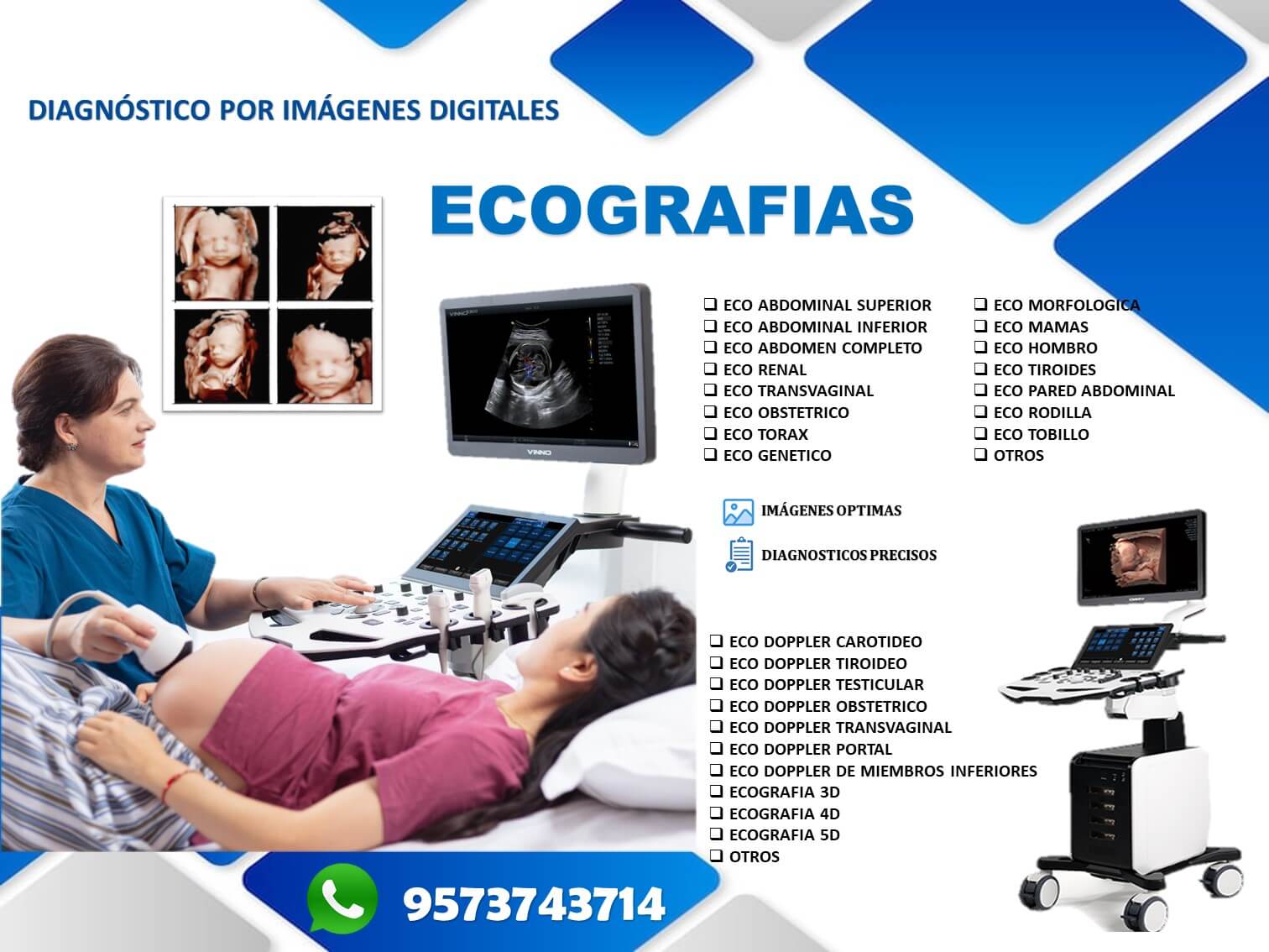 Resonancia de columna